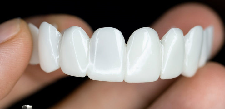 BowLift | Snap-On Cosmetic Veneers | Instant Smile Cover for Imperfections