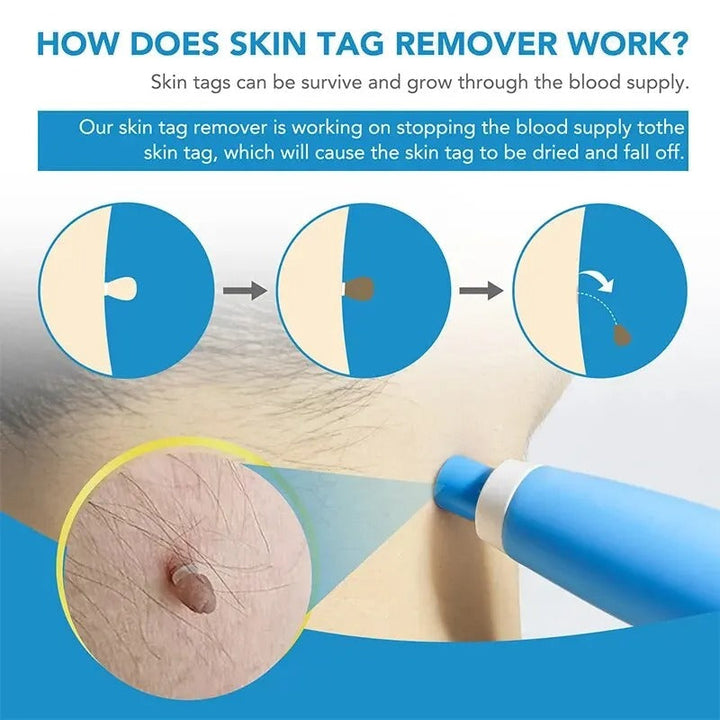 Waxing Hair Removal Kit Bowlift