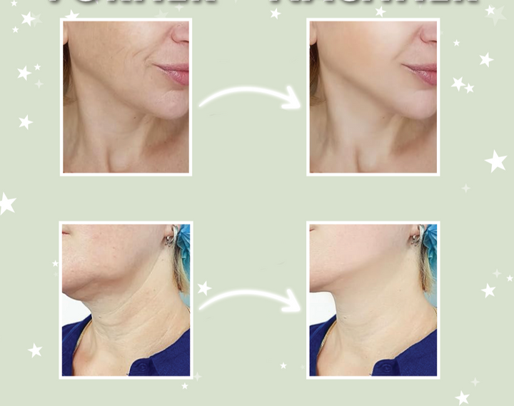 BowLift | LuxéDerm Anti-Aging Serum | For a wrinkle-free, radiantly beautiful skin