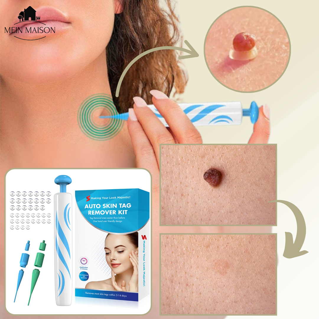 BowLift | DermaLinx Wart Remover | Pain-Free Removal of Warts & Moles | For Home | Without Surgery