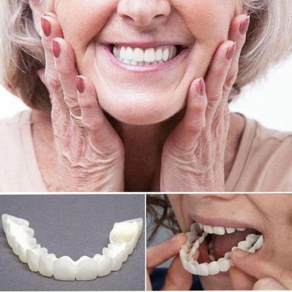 BowLift | On Smile Veneers (Upper and Lower Jaw included)