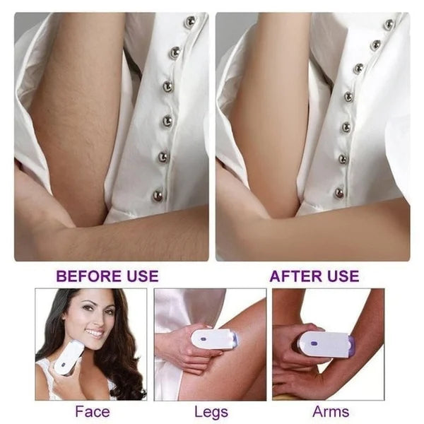 BowLift | Silky Smooth Hair Eraser