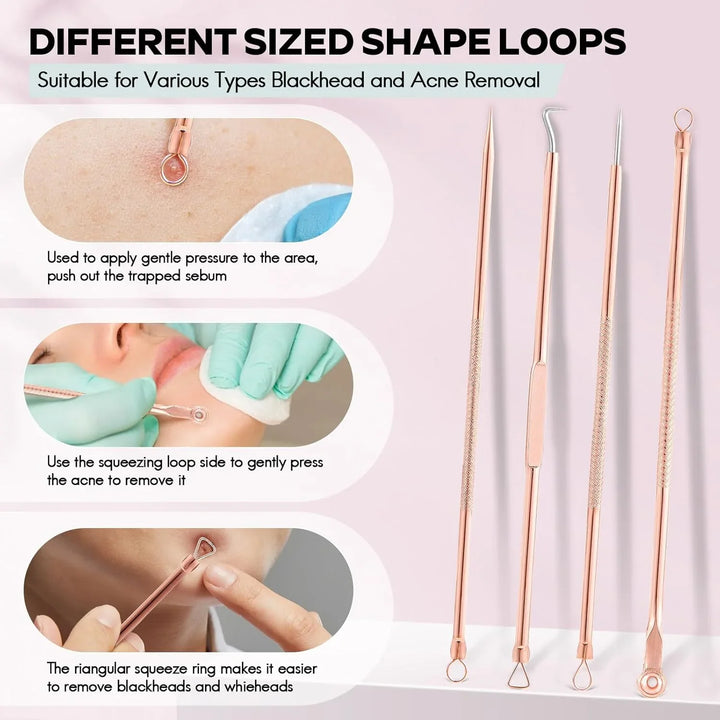 BowLift | Blackhead and pimple removal set