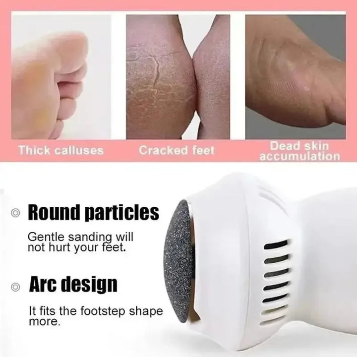 BowLift | Electric Professional Callus Remover
