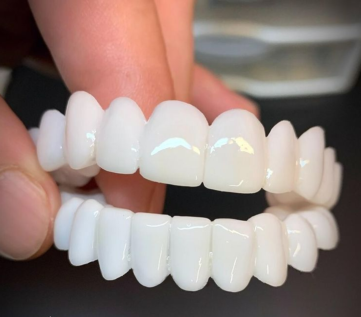 BowLift | Smile Lens – Adjustable White Denture for Direct Smile Correction