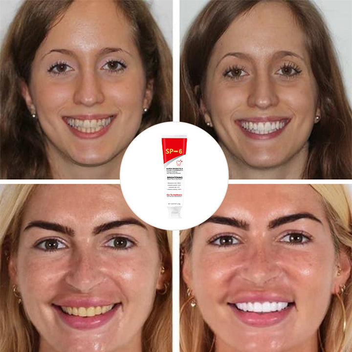 BowLift | Super Probiotic-6 Toothpaste