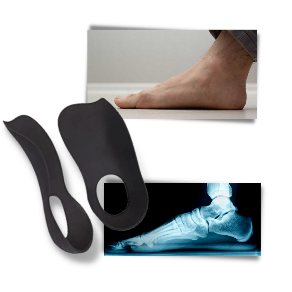 BowLift | Orthopedic insoles for flat feet