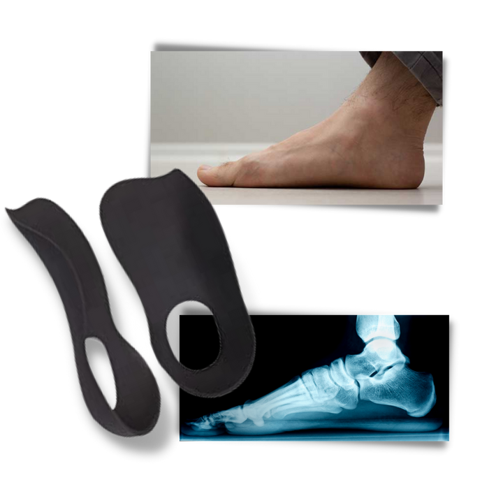 BowLift | Orthopedic insoles for flat feet