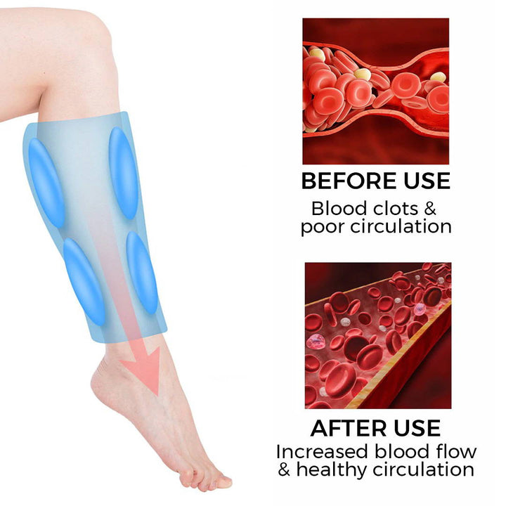 BowLift | Wireless Leg Massager - LegEase