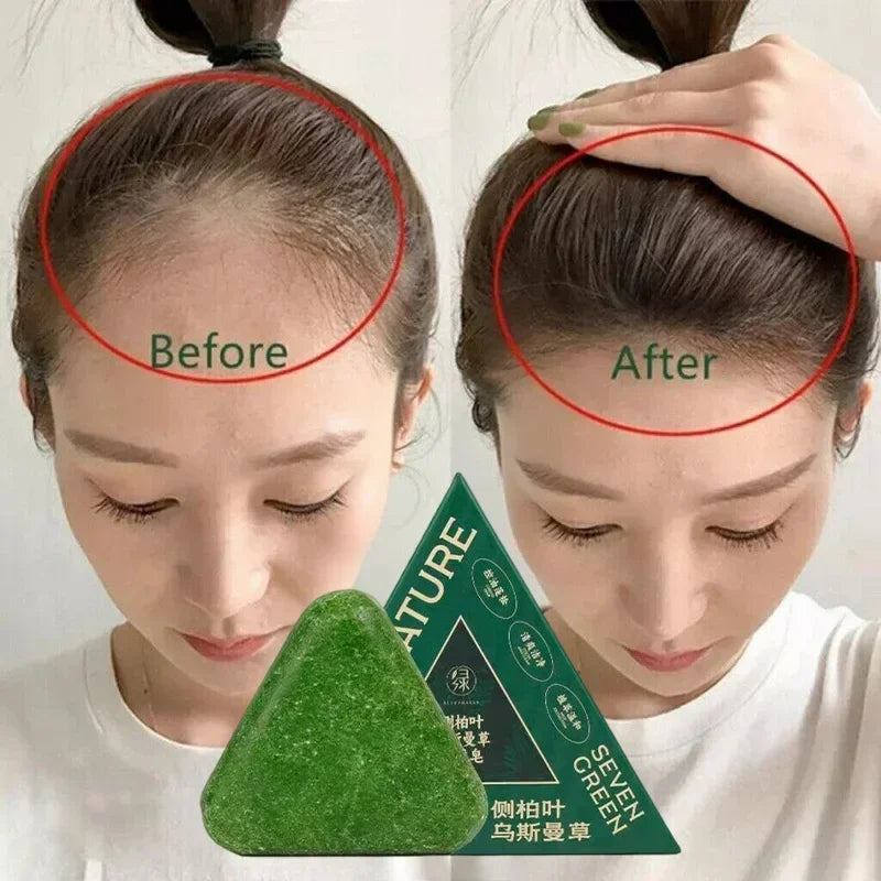 BowLift | Herbal Anti-Hair Loss Shampoo Bar