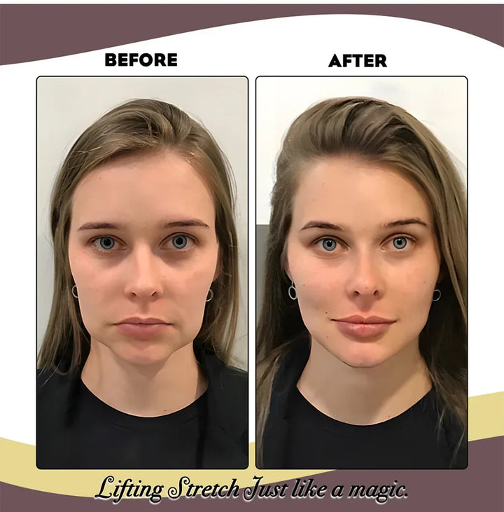 BowLift | Elastic Face Lifting Band