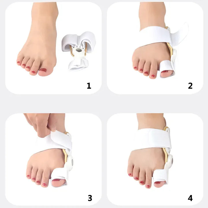 BowLift | Flexible Orthopaedic Bunion Corrector