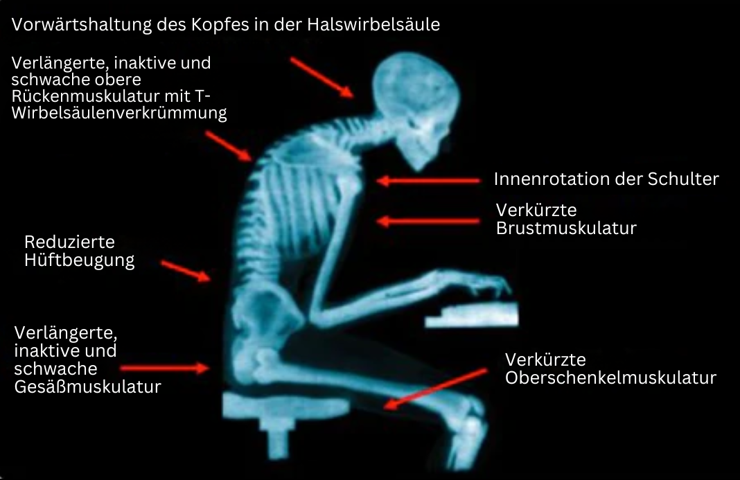 BowLift | EMS-Posture Bandage - PosturePro