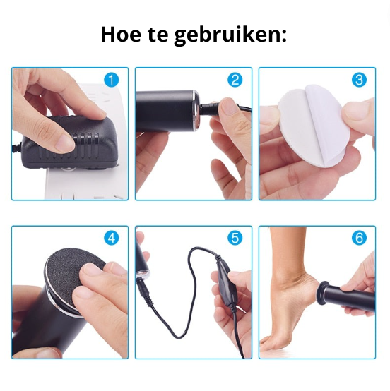 SmoothFeet – Luxe Elektrische Pedicure Vijl Bowlift