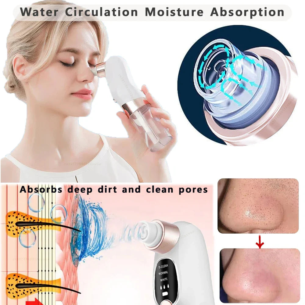 BowLift | Acne Black Head Deep Clean Removal