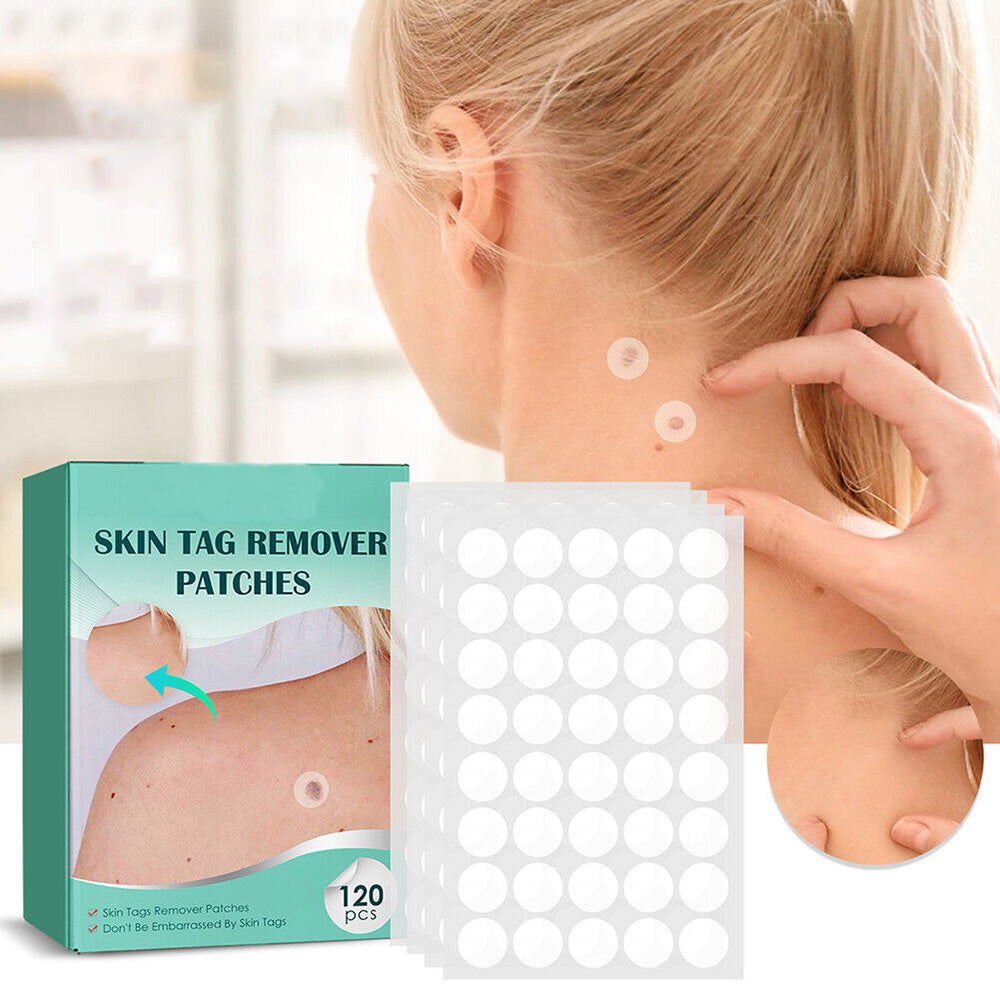 SkinClear - Patch for the removal of spots and warts Bowlift