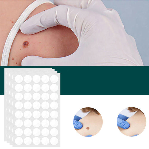 SkinClear - Patch for the removal of spots and warts Bowlift