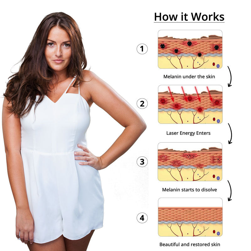 Tattoo Removal Laser Bowlift