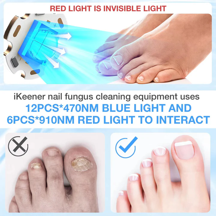 BowLift | Nail Fungus Laser