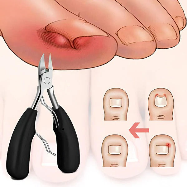 BowLift | Premium Nail Care Kit with Accessories
