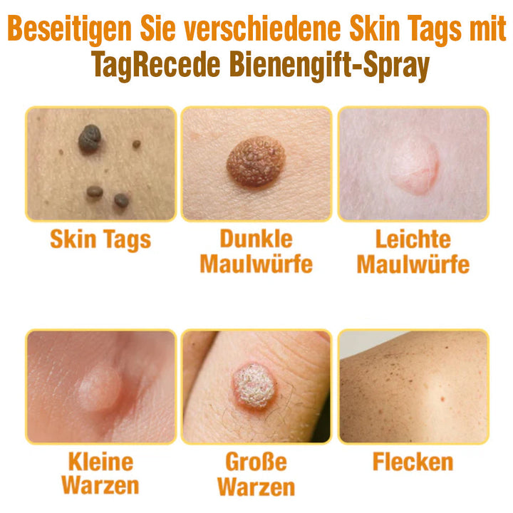 TagRecede Bee Gift Spray | Natural Skin Perfection | Bowlift