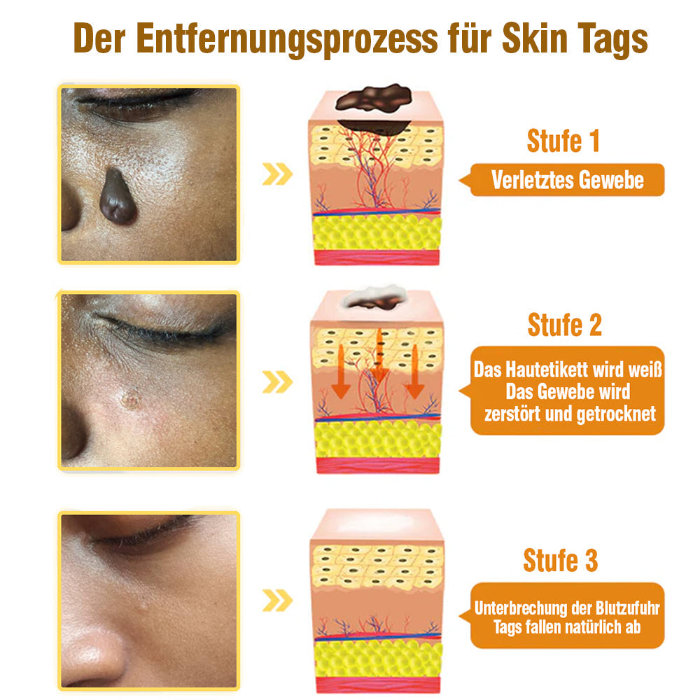 TagRecede Bee Gift Spray | Natural Skin Perfection | Bowlift