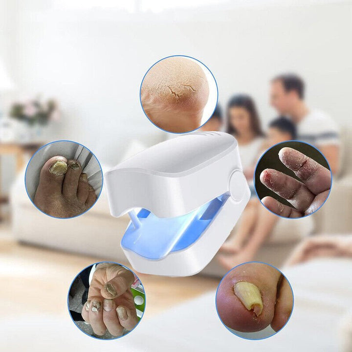 Laser device for nail fungus cleaning – Revolutionary, highly efficient light therapy device from Expert for toenail diseases Bowlift