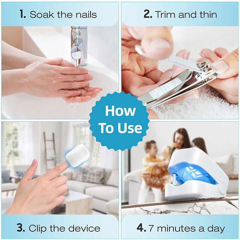Laser device for nail fungus cleaning – Revolutionary, highly efficient light therapy device from Expert for toenail diseases Bowlift