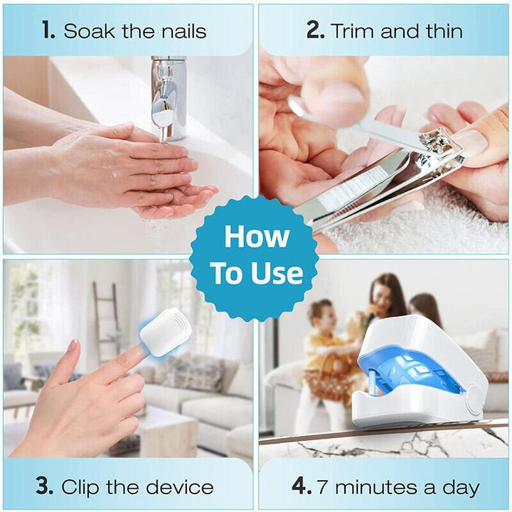 Laser device for nail fungus cleaning – Revolutionary, highly efficient light therapy device from Expert for toenail diseases Bowlift