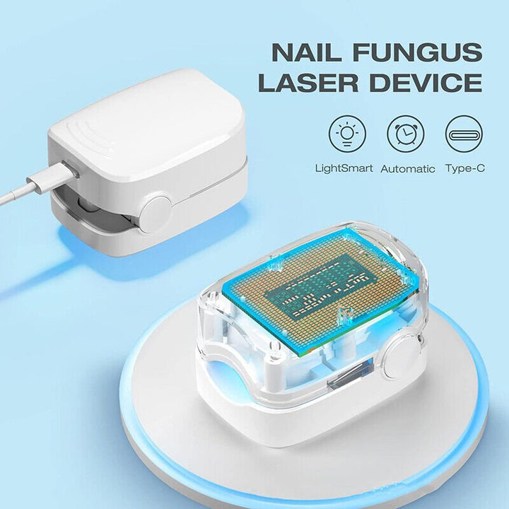 Laser device for nail fungus cleaning – Revolutionary, highly efficient light therapy device from Expert for toenail diseases Bowlift