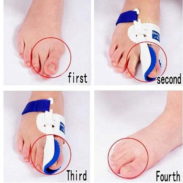 BowLift | 1 pair Bunion Adjuster Orthotics